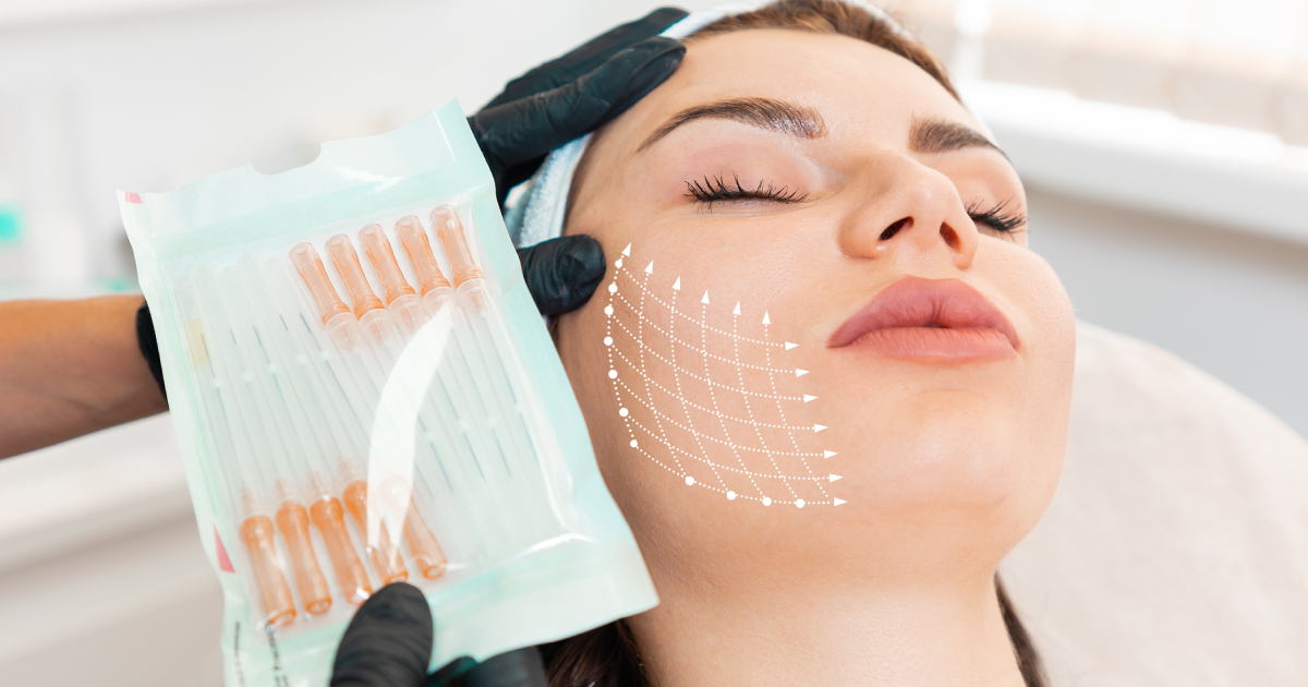Doctor performing PDO thread lift Treatment on a woman in Lake Charles, LA
